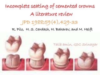 Incomplete seating of cemented crowns
A literature review
JPD 1988;59(4),429-33
R. Pilo, H. S. Cardash, H. Baharav, and M. Helft
Talib amin, GDC Srinagar
 