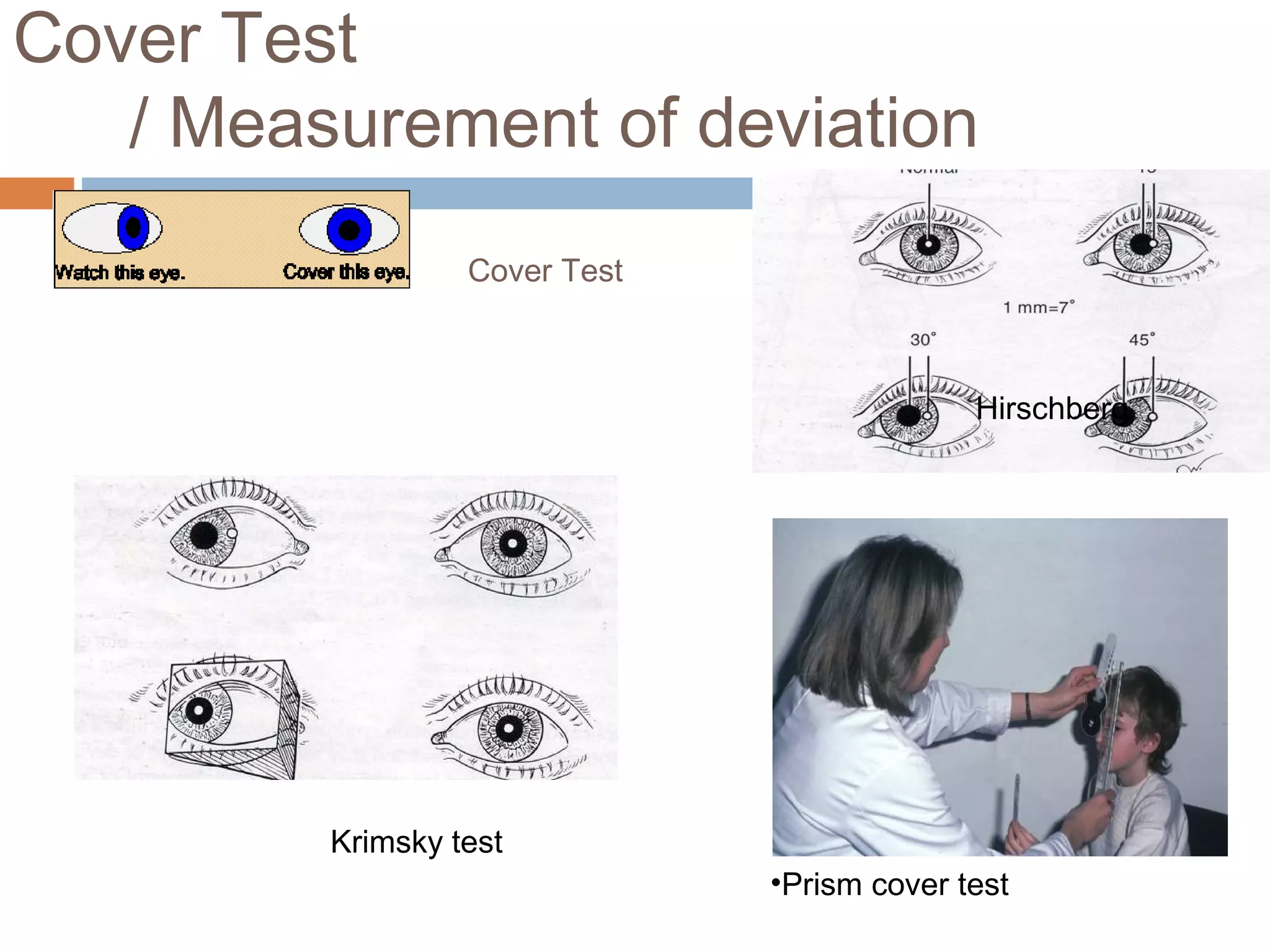Cover Test
/ Measurement of deviation
Hirschberg
Krimsky test
•Prism cover test
Cover Test
 