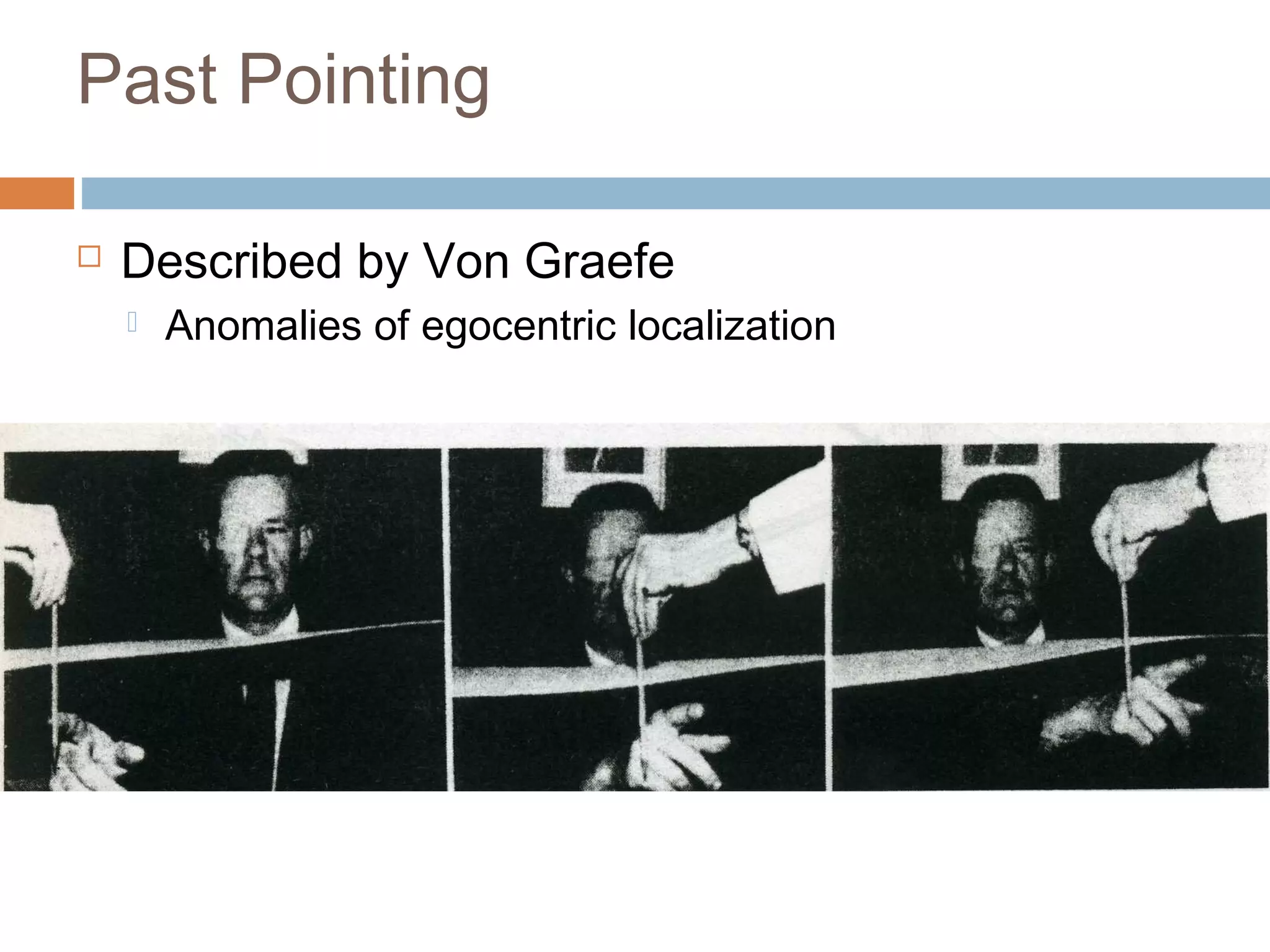 Past Pointing
 Described by Von Graefe
 Anomalies of egocentric localization
 