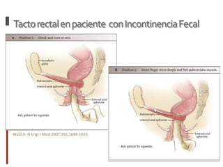 Tacto rectal en paciente  con Incontinencia FecalWald A. N Engl J Med 2007;356:1648-1655