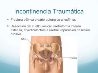 Incontinencia Traumática
 Fractura pélvica o daño quirúrgico al esfínter.

 Resección del cuello vesical, uretrotomía interna
extensa, diverticulectomía uretral, reparación de lesión
erosiva.

 