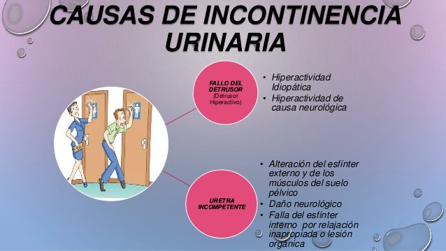 Por qué he adelgazado durante el embarazo
