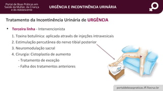portaldeboaspraticas.iff.fiocruz.br
URGÊNCIA E INCONTINÊNCIA URINÁRIA
• Terceira linha - Intervencionista
1. Toxina botulínica: aplicada através de injeções intravesicais
2. Estimulação percutânea do nervo tibial posterior
3. Neuromodulação sacral
4. Cirurgia: Cistoplastia de aumento
- Tratamento de exceção
- Falha dos tratamentos anteriores
Tratamento da Incontinência Urinária de URGÊNCIA
 