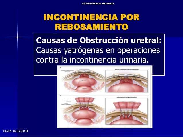 El dolor en lo bajo del vientre cuando estoy sobre la espalda