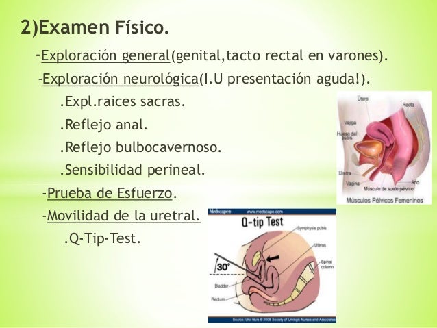 incontinencia urinaria de esfuerzo ppt Incontinencia urinaria final. Ppt.