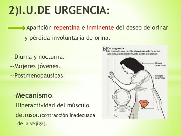 incontinencia urinaria de esfuerzo ppt 2014-06-12) incontinencia urinaria (ppt).