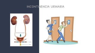 incontinencia urinaria
 