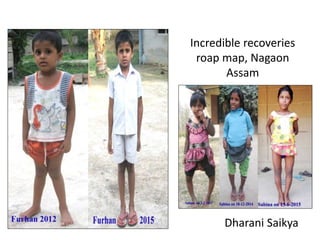 Incredible recoveries
roap map, Nagaon
Assam
Dharani Saikya
 