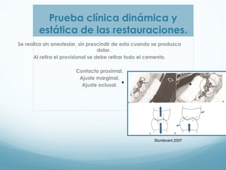 Incrustaciones | PPT