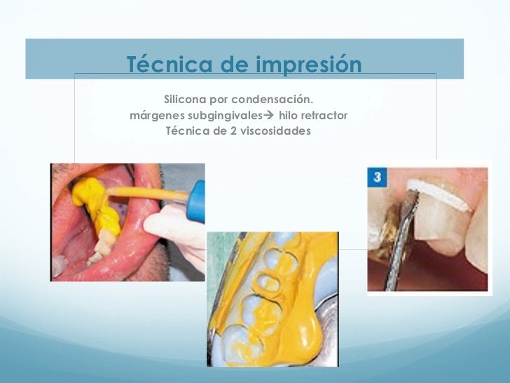 Incrustaciones