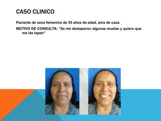 CASO CLINICO
Paciente de sexo femenino de 55 años de edad, ama de casa.
MOTIVO DE CONSULTA: “Se me destaparon algunas muelas y quiero que
  me las tapen”
 
