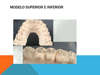 MODELO SUPERIOR E INFERIOR
 