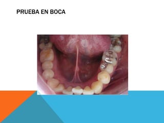 PRUEBA EN BOCA
 