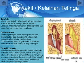 Penyakit / Kelainan Telinga
Cellulitis
Infeksi yang terjadi pada daerah telinga luar atau
external ear, salah satunya adalah penyakit
Cellulitis. Infeksi telinga luar ini dapat berulang jika
tidak diberikan perawatan yang benar.
Cholesteatoma
Jika telinga tengah Anda terjadi penumpukan
cellular debris atau puing-puing selular akan
mengakibatkan infeksi kronis telinga.
Cholesteatoma bisa mengakibatkan kerusakan
pada struktur dalam telinga di bagian tengah.
Penyakit Meniere
Yang berikutnya adalah penyakit Meniere. Penyakit
ini terjadi karena peningkatan jumlah cairan pada
labyrin. Dan biasanya penyakit Meniere menyerang
orang setengah baya. Cara menyembuhkan adalah
dengan berkonsultasi ke dokter tht, Anda tidak
dapat menyembuhkannya sendiri.
 