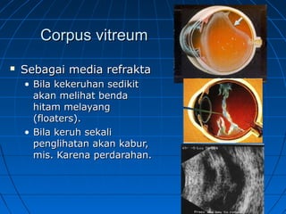 CCoorrppuuss vviittrreeuumm 
 SSeebbaaggaaii mmeeddiiaa rreeffrraakkttaa 
• BBiillaa kkeekkeerruuhhaann sseeddiikkiitt 
aakkaann mmeelliihhaatt bbeennddaa 
hhiittaamm mmeellaayyaanngg 
((ffllooaatteerrss)).. 
• BBiillaa kkeerruuhh sseekkaallii 
ppeenngglliihhaattaann aakkaann kkaabbuurr,, 
mmiiss.. KKaarreennaa ppeerrddaarraahhaann.. 
 