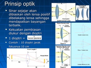 PPrriinnssiipp ooppttiikk 
 SSiinnaarr sseejjaajjaarr aakkaann 
ddiibbiiaasskkaann oolleehh lleennssaa ppoossiittiiff 
ddiibbeellaakkaanngg lleennssaa sseehhiinnggggaa 
mmeennddaappaattkkaann bbaayyaannggaann 
tteerrbbaalliikk.. 
 KKeekkuuaattaann ppeemmbbiiaassaann 
ddiiuukkuurr ddeennggaann ddiiooppttrrii 
 11 ddiiooppttrrii == 
 CCoonnttoohh :: 1100 ddiiooppttrrii jjaarraakk 
ffookkuussnnyyaa 1100 ccmm 
 