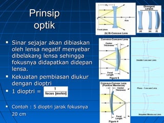 PPrriinnssiipp 
ooppttiikk 
 SSiinnaarr sseejjaajjaarr aakkaann ddiibbiiaasskkaann 
oolleehh lleennssaa nneeggaattiiff mmeennyyeebbaarr 
ddiibbeellaakkaanngg lleennssaa sseehhiinnggggaa 
ffookkuussnnyyaa ddiiddaappaattkkaann ddiiddeeppaann 
lleennssaa.. 
 KKeekkuuaattaann ppeemmbbiiaassaann ddiiuukkuurr 
ddeennggaann ddiiooppttrrii 
 11 ddiiooppttrrii == 
 CCoonnttoohh :: 55 ddiiooppttrrii jjaarraakk ffookkuussnnyyaa 
2200 ccmm 
 