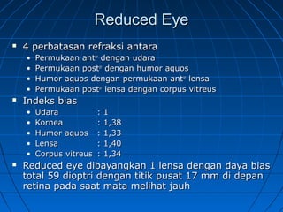 RReedduucceedd EEyyee 
 44 ppeerrbbaattaassaann rreeffrraakkssii aannttaarraa 
• PPeerrmmuukkaaaann aannttoorr ddeennggaann uuddaarraa 
• PPeerrmmuukkaaaann ppoossttoorr ddeennggaann hhuummoorr aaqquuooss 
• HHuummoorr aaqquuooss ddeennggaann ppeerrmmuukkaaaann aannttoorr lleennssaa 
• PPeerrmmuukkaaaann ppoossttoorr lleennssaa ddeennggaann ccoorrppuuss vviittrreeuuss 
 IInnddeekkss bbiiaass 
• UUddaarraa :: 11 
• KKoorrnneeaa :: 11,,3388 
• HHuummoorr aaqquuooss :: 11,,3333 
• LLeennssaa :: 11,,4400 
• CCoorrppuuss vviittrreeuuss :: 11,,3344 
 RReedduucceedd eeyyee ddiibbaayyaannggkkaann 11 lleennssaa ddeennggaann ddaayyaa bbiiaass 
ttoottaall 5599 ddiiooppttrrii ddeennggaann ttiittiikk ppuussaatt 1177 mmmm ddii ddeeppaann 
rreettiinnaa ppaaddaa ssaaaatt mmaattaa mmeelliihhaatt jjaauuhh 
 