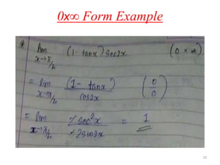 1515
0x∞ Form Example
15
 