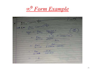 ∞⁰ Form Example
26
 