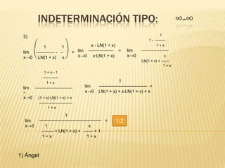 INDETERMINACIÓN TIPO:                                                 ∞-∞
  3)                                                                   1
                                                                1 - ⎯⎯⎯⎯⎯
      ⎛ 1         1⎞         x - LN(1 + x)                          1+x
  lim  ⎯⎯⎯⎯⎯⎯⎯⎯ - ⎯   = lim ⎯⎯⎯⎯⎯⎯⎯⎯⎯⎯⎯ =            lim    ⎯⎯⎯⎯⎯⎯⎯⎯⎯⎯⎯⎯⎯⎯
  x→0 ⎝ LN(1 + x) x ⎠   x→0 x·LN(1 + x)              x→0                 x
                                                            LN(1 + x) + ⎯⎯⎯⎯
                                                                         1+x
             1+x-1
            ⎯⎯⎯⎯⎯⎯⎯⎯
              1+x                                1
  lim   ⎯⎯⎯⎯⎯⎯⎯⎯⎯⎯⎯⎯⎯⎯⎯⎯⎯⎯⎯      lim   ⎯⎯⎯⎯⎯⎯⎯⎯⎯⎯⎯⎯⎯⎯⎯⎯⎯⎯⎯⎯⎯ =
  =                              x→0   LN(1 + x) + x·LN(1 + x) + x
  x→0    (1 + x)·LN(1 + x) + x
          ⎯⎯⎯⎯⎯⎯⎯⎯⎯⎯⎯⎯⎯⎯⎯⎯⎯
               1+x

                       1
  lim      ⎯⎯⎯⎯⎯⎯⎯⎯⎯⎯⎯⎯⎯⎯⎯⎯⎯⎯⎯⎯⎯⎯⎯⎯⎯⎯⎯ =       1/2
  x→0         1                   x
            ⎯⎯⎯⎯⎯ + LN(1 + x) + ⎯⎯⎯⎯ + 1
            1+x                  1+x



1) Ángel
 
