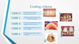 Coding criteria
• No periodontal disease
• Healthy periodontium
Code 0
Bleeding observed during
or after probing
Code 1
• Presence of calculus or other
plaque retentive factors.
Code 2
• Pathological pocket 4 to 5.5
mm in depth
Code 3
• Pathological pocket > 6mm
in depth
Code 4
 