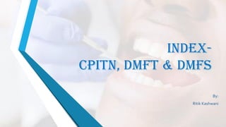 INDEX-
CPITN, DMFT & DMFS
By:
Ritik Kashwani
 