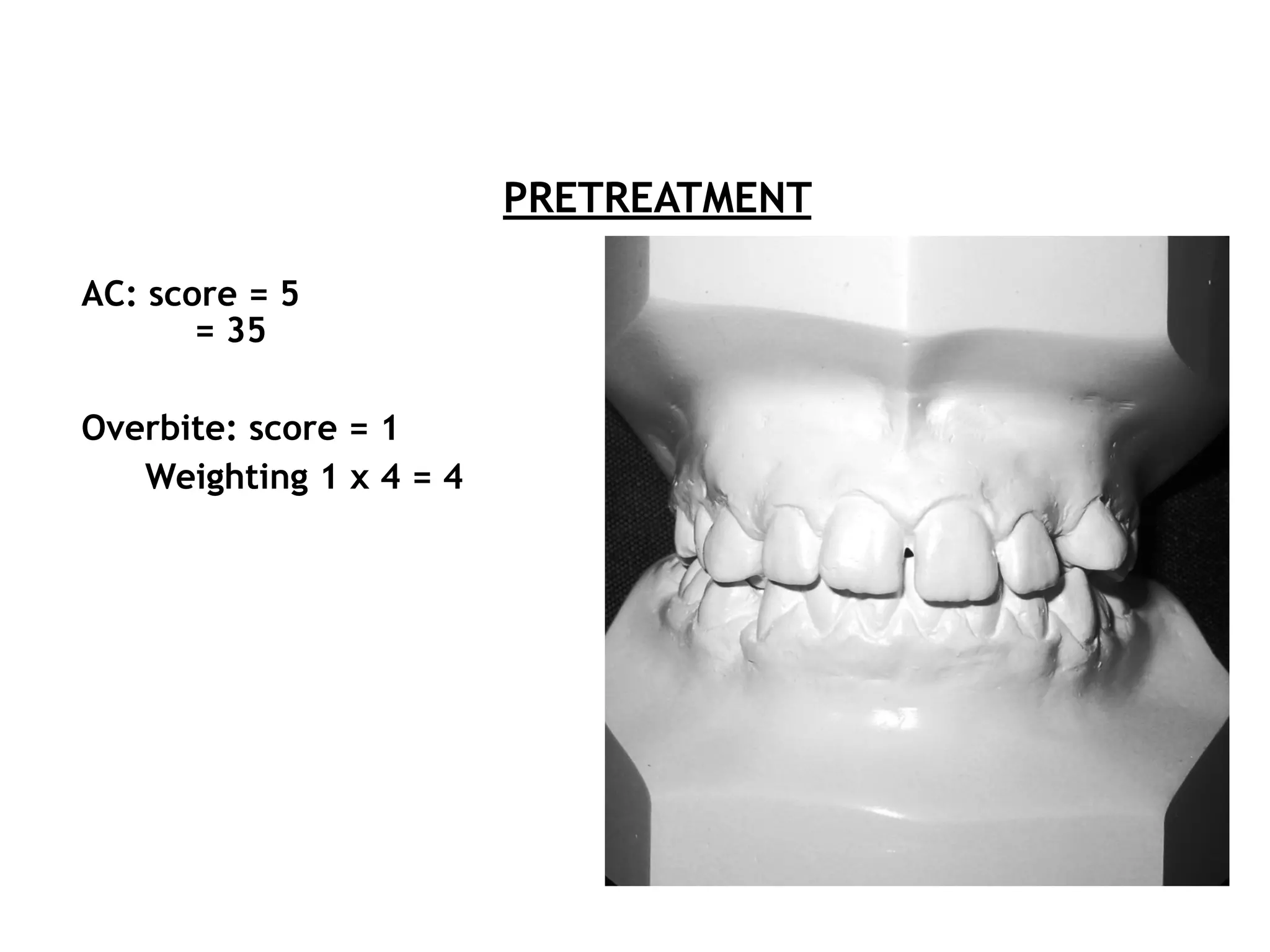 Index of Complexity, Outcome and Need (ICON) - Orthodontic Index | PDF