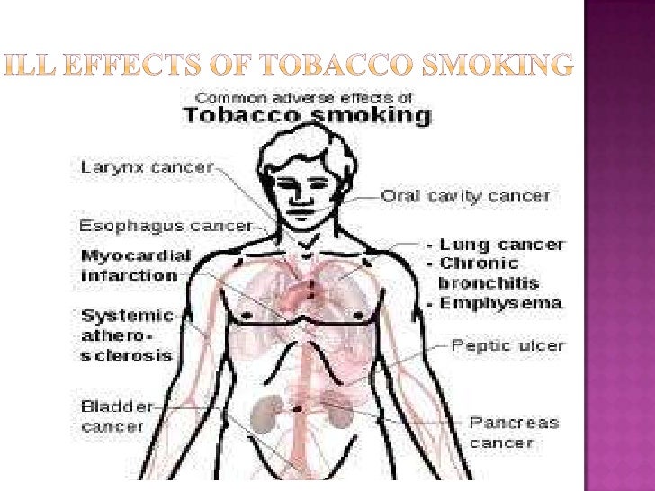 Ind hin 0047 ill effects of tobacco smoking