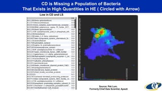 CD is Missing a Population of Bacteria
That Exists in High Quantities in HE ( Circled with Arrow)
Low in CD and LS
Source: Pek Lum,
Formerly Chief Data Scientist, Ayasdi
 