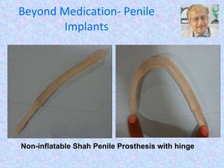 Beyond Medication- Penile Implants Non-inflatable Shah Penile Prosthesis with hinge 