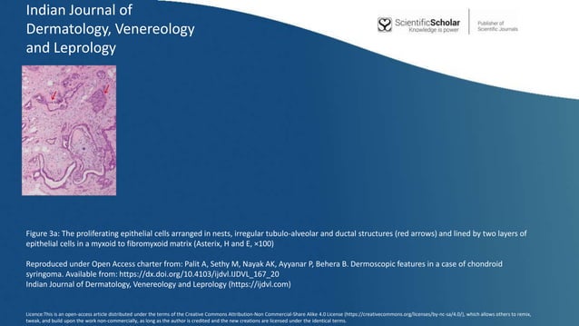 Indian Journal of Dermatology, Venereology and Leprology.pptx