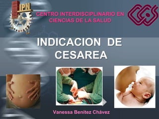 CENTRO INTERDISCIPLINARIO EN
    CIENCIAS DE LA SALUD



INDICACION DE
   CESAREA



                   Your Logo


     Vanessa Benítez Chávez
 