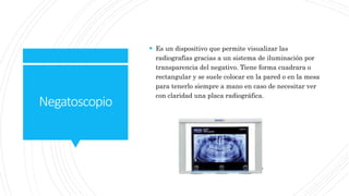 Negatoscopio
 Es un dispositivo que permite visualizar las
radiografías gracias a un sistema de iluminación por
transparencia del negativo. Tiene forma cuadrara o
rectangular y se suele colocar en la pared o en la mesa
para tenerlo siempre a mano en caso de necesitar ver
con claridad una placa radiográfica.
 