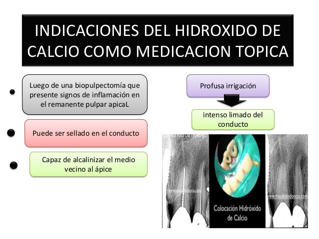 Indicaciones del hidroxido de calcio como medicacion topica