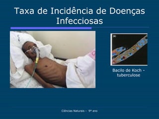 Taxa de Incidência de Doenças
         Infecciosas




                                       Bacilo de Koch -
                                         tuberculose




          Ciências Naturais - 9º ano
 