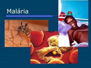 Malária




          Ciências Naturais - 9º ano
 