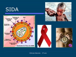 SIDA




       Ciências Naturais - 9º ano
 