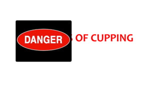 DANGERS OF CUPPING
 