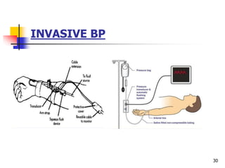 INVASIVE BP
30
 
