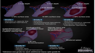 Splenectomized Patient splenectomy and its complications.pptx