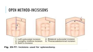 splenectomy and its complications.pptx