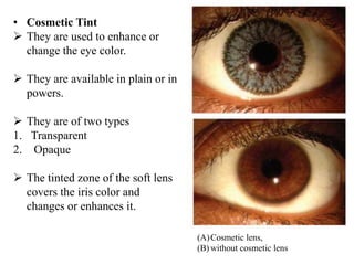 clinical try of beyond contact lenses