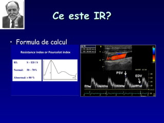Ce este IR?Ce este IR?
• Formula de calcul
 