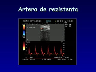 Artera de rezistentaArtera de rezistenta
 