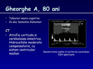 Gheorghe A, 80 ani
• Tulburari neuro-cognitive
• In obs. Dementa Alzheimer
CTCT
• Atrofie corticala si
cerebeloasa simetrica.
Hidrocefalie moderata
compensatorie, cu
sistem ventricular
median
Rezistivitate inalta in teritoriul carotidian
EDV aplatizata
 