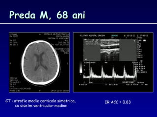 Preda M, 68 aniPreda M, 68 ani
IR ACC = 0.83CT : atrofie medie corticala simetrica,
cu sisetm ventricular median
 