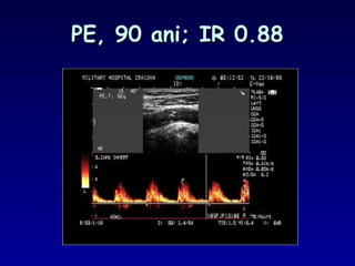 PE, 90 ani; IR 0.88PE, 90 ani; IR 0.88
 