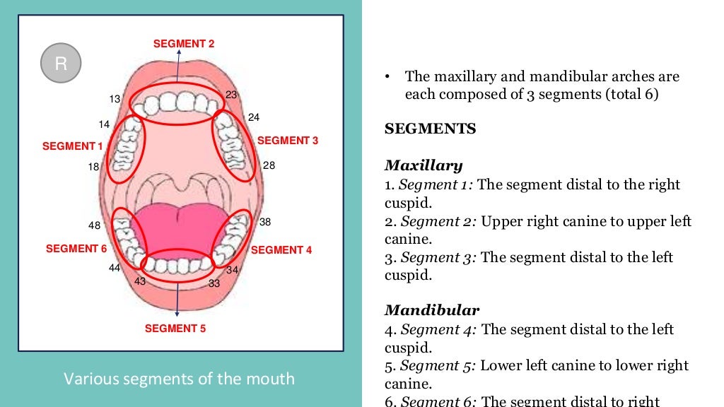 Oral Hygiene Index (OHI) and Oral Hygiene IndexSimplified (OHIS)