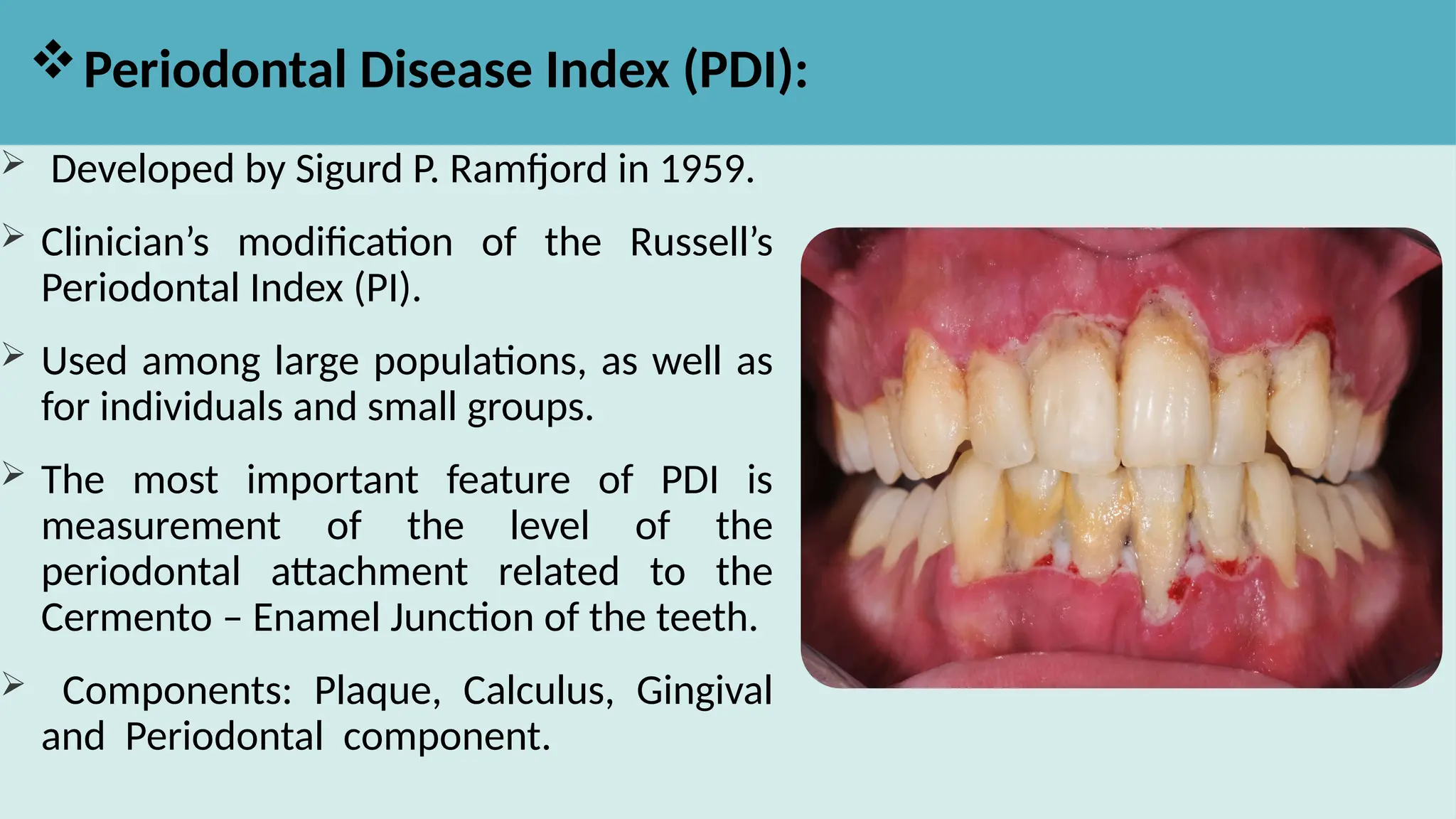 Indices used in public health dentistry.pptx